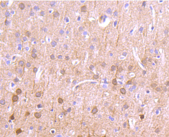 Immunohistochemical analysis of paraffin-embedded rat brain tissue using anti-CaMKII delta antibody. The section was pre-treated using heat mediated antigen retrieval with Tris-EDTA buffer (pH 8.0-8.4) for 20 minutes.The tissues were blocked in 5% BSA for 30 minutes at room temperature, washed with ddH2O and PBS, and then probed with the primary antibody (ET1704-37, 1/50) for 30 minutes at room temperature. The detection was performed using an HRP conjugated compact polymer system. DAB was used as the chromogen. Tissues were counterstained with hematoxylin and mounted with DPX.