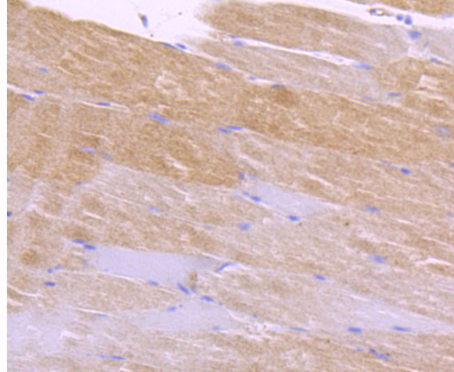 Immunohistochemical analysis of paraffin-embedded mouse skeletal muscle tissue using anti-CaMKII delta antibody. The section was pre-treated using heat mediated antigen retrieval with Tris-EDTA buffer (pH 8.0-8.4) for 20 minutes.The tissues were blocked in 5% BSA for 30 minutes at room temperature, washed with ddH2O and PBS, and then probed with the primary antibody (ET1704-37, 1/50) for 30 minutes at room temperature. The detection was performed using an HRP conjugated compact polymer system. DAB was used as the chromogen. Tissues were counterstained with hematoxylin and mounted with DPX.