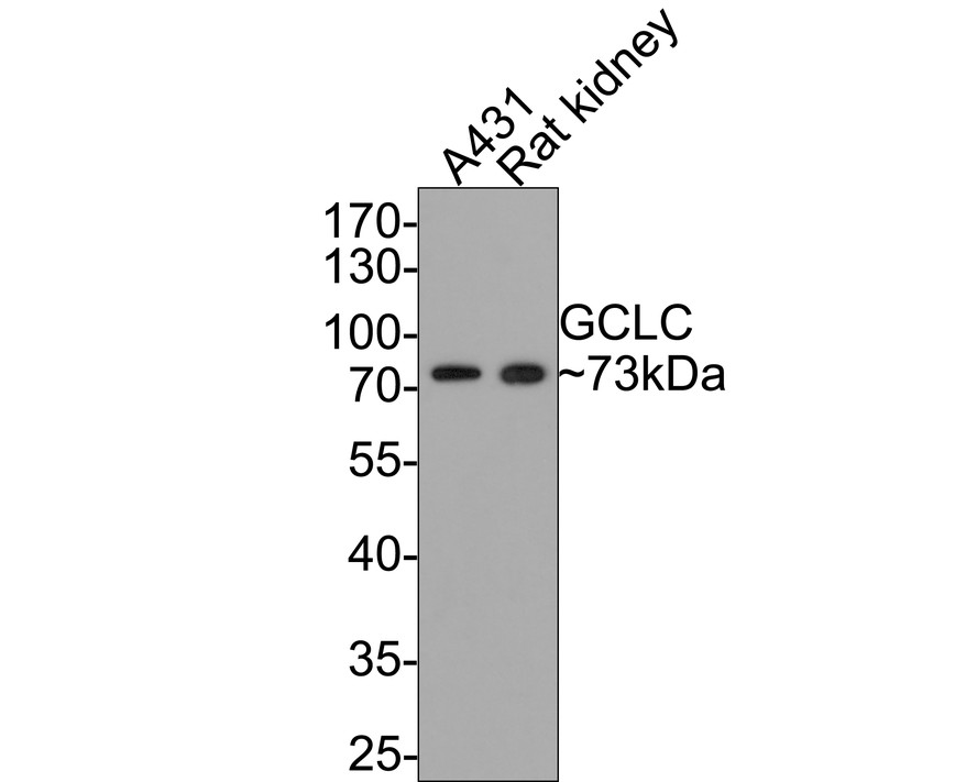 Western blot analysis of GCLC on different lysates with Rabbit anti-GCLC antibody (ET1704-38) at 1/500 dilution.<br />
<br />
Lane 1: A431 cell lysate<br />
Lane 2: Rat kidney tissue lysate (20 µg/Lane)<br />
<br />
Lysates/proteins at 10 µg/Lane.<br />
<br />
Predicted band size: 73 kDa<br />
Observed band size: 73 kDa<br />
<br />
Exposure time: 2 minutes;<br />
<br />
10% SDS-PAGE gel.<br />
<br />
Proteins were transferred to a PVDF membrane and blocked with 5% NFDM/TBST for 1 hour at room temperature. The primary antibody (ET1704-38) at 1/500 dilution was used in 5% NFDM/TBST at room temperature for 2 hours. Goat Anti-Rabbit IgG - HRP Secondary Antibody (HA1001) at 1:200,000 dilution was used for 1 hour at room temperature.