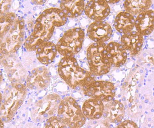 Immunohistochemical analysis of paraffin-embedded rat kidney tissue with Rabbit anti-GCLC antibody (ET1704-38) at 1/50 dilution.<br />
<br />
The section was pre-treated using heat mediated antigen retrieval with Tris-EDTA buffer (pH 9.0) for 20 minutes. The tissues were blocked in 1% BSA for 20 minutes at room temperature, washed with ddH2O and PBS, and then probed with the primary antibody (ET1704-38) at 1/50 dilution for 1 hour at room temperature. The detection was performed using an HRP conjugated compact polymer system. DAB was used as the chromogen. Tissues were counterstained with hematoxylin and mounted with DPX.