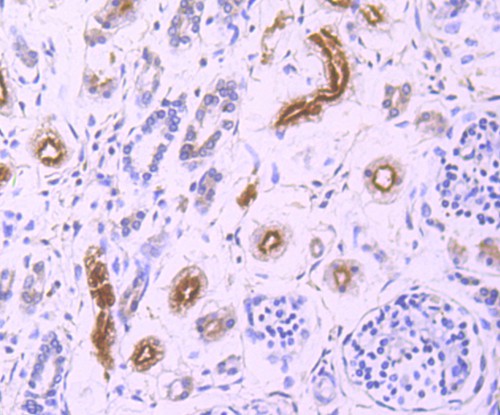 Immunohistochemical analysis of paraffin-embedded human fetal kidney tissue with Rabbit anti-GCLC antibody (ET1704-38) at 1/50 dilution.<br />
<br />
The section was pre-treated using heat mediated antigen retrieval with Tris-EDTA buffer (pH 9.0) for 20 minutes. The tissues were blocked in 1% BSA for 20 minutes at room temperature, washed with ddH2O and PBS, and then probed with the primary antibody (ET1704-38) at 1/50 dilution for 1 hour at room temperature. The detection was performed using an HRP conjugated compact polymer system. DAB was used as the chromogen. Tissues were counterstained with hematoxylin and mounted with DPX.