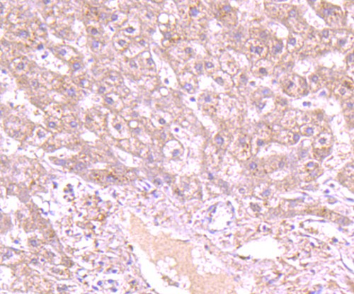 Immunohistochemical analysis of paraffin-embedded human fetal liver tissue with Rabbit anti-GCLC antibody (ET1704-38) at 1/50 dilution.<br />
<br />
The section was pre-treated using heat mediated antigen retrieval with Tris-EDTA buffer (pH 9.0) for 20 minutes. The tissues were blocked in 1% BSA for 20 minutes at room temperature, washed with ddH2O and PBS, and then probed with the primary antibody (ET1704-38) at 1/50 dilution for 1 hour at room temperature. The detection was performed using an HRP conjugated compact polymer system. DAB was used as the chromogen. Tissues were counterstained with hematoxylin and mounted with DPX.