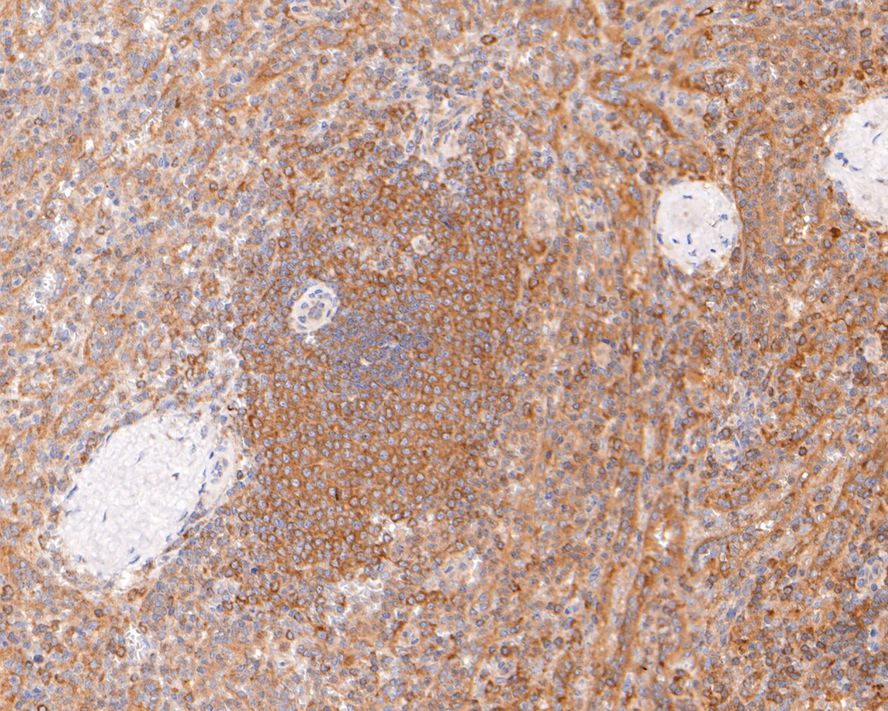 Immunohistochemical analysis of paraffin-embedded human spleen tissue with Rabbit anti-IKK gamma antibody (ET1704-40) at 1/400 dilution.<br />
<br />
The section was pre-treated using heat mediated antigen retrieval with sodium citrate buffer (pH 6.0) for 2 minutes. The tissues were blocked in 1% BSA for 20 minutes at room temperature, washed with ddH2O and PBS, and then probed with the primary antibody (ET1704-40) at 1/400 dilution for 1 hour at room temperature. The detection was performed using an HRP conjugated compact polymer system. DAB was used as the chromogen. Tissues were counterstained with hematoxylin and mounted with DPX.