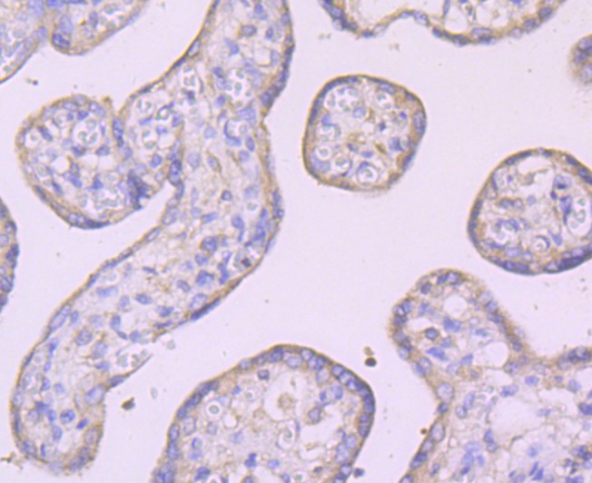 Immunohistochemical analysis of paraffin-embedded human placenta tissue using anti-IKK gamma antibody. The section was pre-treated using heat mediated antigen retrieval with Tris-EDTA buffer (pH 8.0-8.4) for 20 minutes.The tissues were blocked in 5% BSA for 30 minutes at room temperature, washed with ddH2O and PBS, and then probed with the primary antibody (ET1704-40, 1/50) for 30 minutes at room temperature. The detection was performed using an HRP conjugated compact polymer system. DAB was used as the chromogen. Tissues were counterstained with hematoxylin and mounted with DPX.