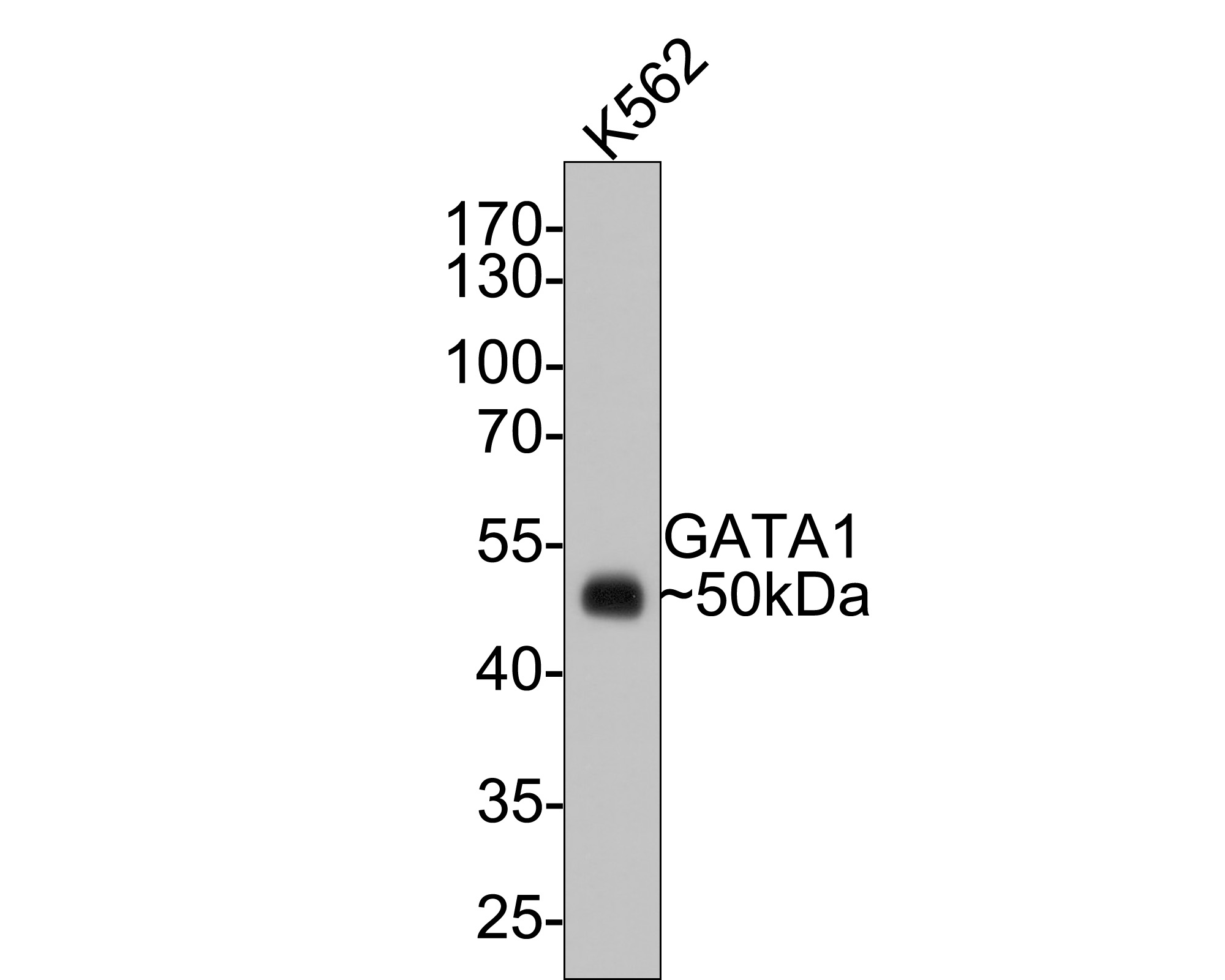 Western blot analysis of GATA1 on K562 cell lysates with Rabbit anti-GATA1 antibody (ET1704-41) at 1/500 dilution.<br />
<br />
Lysates/proteins at 10 µg/Lane.<br />
<br />
Predicted band size: 43 kDa<br />
Observed band size: 50 kDa<br />
<br />
Exposure time: 30 seconds;<br />
<br />
10% SDS-PAGE gel.<br />
<br />
Proteins were transferred to a PVDF membrane and blocked with 5% NFDM/TBST for 1 hour at room temperature. The primary antibody (ET1704-41) at 1/500 dilution was used in 5% NFDM/TBST at room temperature for 2 hours. Goat Anti-Rabbit IgG - HRP Secondary Antibody (HA1001) at 1:300,000 dilution was used for 1 hour at room temperature.
