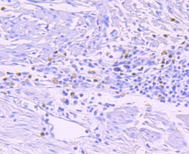 Immunohistochemical analysis of paraffin-embedded human liver tissue using anti-GATA1 antibody. The section was pre-treated using heat mediated antigen retrieval with Tris-EDTA buffer (pH 9.0) for 20 minutes.The tissues were blocked in 5% BSA for 30 minutes at room temperature, washed with ddH2O and PBS, and then probed with the primary antibody (ET1704-41, 1/50) for 30 minutes at room temperature. The detection was performed using an HRP conjugated compact polymer system. DAB was used as the chromogen. Tissues were counterstained with hematoxylin and mounted with DPX.