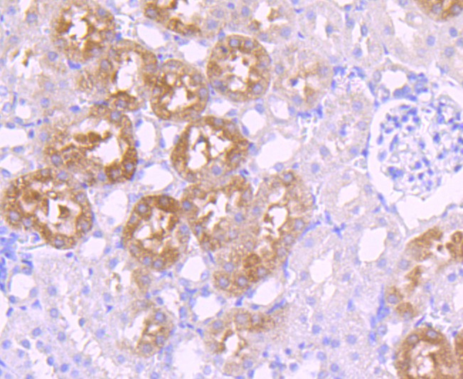 Immunohistochemical analysis of paraffin-embedded human kidney tissue using anti-GATA1 antibody. The section was pre-treated using heat mediated antigen retrieval with Tris-EDTA buffer (pH 9.0) for 20 minutes.The tissues were blocked in 5% BSA for 30 minutes at room temperature, washed with ddH2O and PBS, and then probed with the primary antibody (ET1704-41, 1/50) for 30 minutes at room temperature. The detection was performed using an HRP conjugated compact polymer system. DAB was used as the chromogen. Tissues were counterstained with hematoxylin and mounted with DPX.