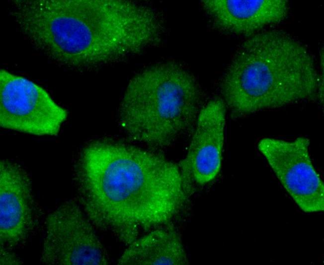 ICC staining of Profilin 1 in A549 cells (green). Formalin fixed cells were permeabilized with 0.1% Triton X-100 in TBS for 10 minutes at room temperature and blocked with 10% negative goat serum for 15 minutes at room temperature. Cells were probed with the primary antibody (ET1704-42, 1/50) for 1 hour at room temperature, washed with PBS. Alexa Fluor®488 conjugate-Goat anti-Rabbit IgG was used as the secondary antibody at 1/1,000 dilution. The nuclear counter stain is DAPI (blue).