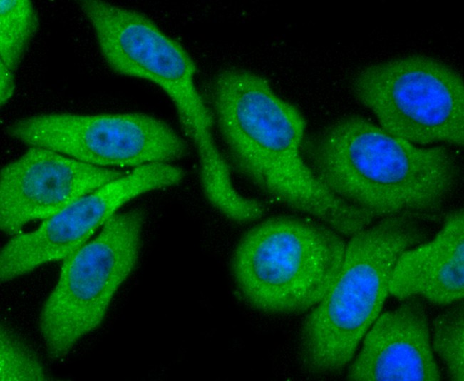 ICC staining of Profilin 1 in HepG2 cells (green). Formalin fixed cells were permeabilized with 0.1% Triton X-100 in TBS for 10 minutes at room temperature and blocked with 10% negative goat serum for 15 minutes at room temperature. Cells were probed with the primary antibody (ET1704-42, 1/50) for 1 hour at room temperature, washed with PBS. Alexa Fluor®488 conjugate-Goat anti-Rabbit IgG was used as the secondary antibody at 1/1,000 dilution. The nuclear counter stain is DAPI (blue).