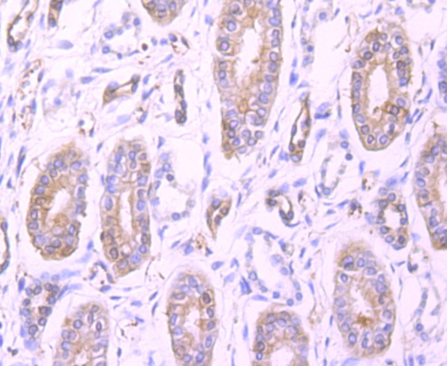 Immunohistochemical analysis of paraffin-embedded human kidney tissue using anti-Profilin 1 antibody. The section was pre-treated using heat mediated antigen retrieval with Tris-EDTA buffer (pH 9.0) for 20 minutes.The tissues were blocked in 1% BSA for 30 minutes at room temperature, washed with ddH2O and PBS, and then probed with the primary antibody (ET1704-42, 1/50) for 30 minutes at room temperature. The detection was performed using an HRP conjugated compact polymer system. DAB was used as the chromogen. Tissues were counterstained with hematoxylin and mounted with DPX.
