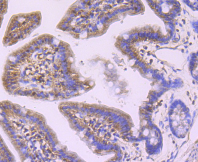 Immunohistochemical analysis of paraffin-embedded mouse colon tissue using anti-Profilin 1 antibody. The section was pre-treated using heat mediated antigen retrieval with Tris-EDTA buffer (pH 9.0) for 20 minutes.The tissues were blocked in 1% BSA for 30 minutes at room temperature, washed with ddH2O and PBS, and then probed with the primary antibody (ET1704-42, 1/50) for 30 minutes at room temperature. The detection was performed using an HRP conjugated compact polymer system. DAB was used as the chromogen. Tissues were counterstained with hematoxylin and mounted with DPX.