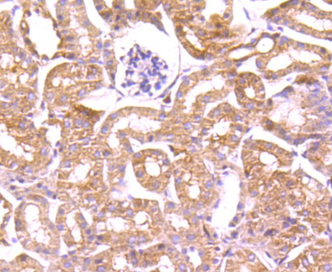 Immunohistochemical analysis of paraffin-embedded mouse kidney tissue using anti-Profilin 1 antibody. The section was pre-treated using heat mediated antigen retrieval with Tris-EDTA buffer (pH 9.0) for 20 minutes.The tissues were blocked in 1% BSA for 30 minutes at room temperature, washed with ddH2O and PBS, and then probed with the primary antibody (ET1704-42, 1/50) for 30 minutes at room temperature. The detection was performed using an HRP conjugated compact polymer system. DAB was used as the chromogen. Tissues were counterstained with hematoxylin and mounted with DPX.