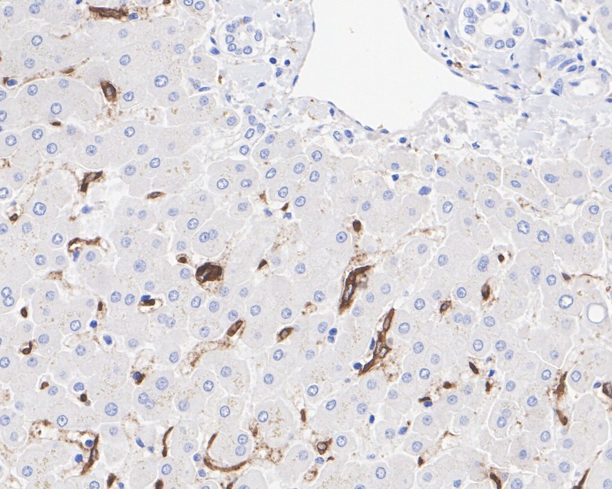 Immunohistochemical analysis of paraffin-embedded human placenta tissue using anti-CD163 antibody. The section was pre-treated using heat mediated antigen retrieval with Tris-EDTA buffer (pH 8.0-8.4) for 20 minutes.The tissues were blocked in 5% BSA for 30 minutes at room temperature, washed with ddH2O and PBS, and then probed with the primary antibody (ET1704-43, 1/50) for 30 minutes at room temperature. The detection was performed using an HRP conjugated compact polymer system. DAB was used as the chromogen. Tissues were counterstained with hematoxylin and mounted with DPX.