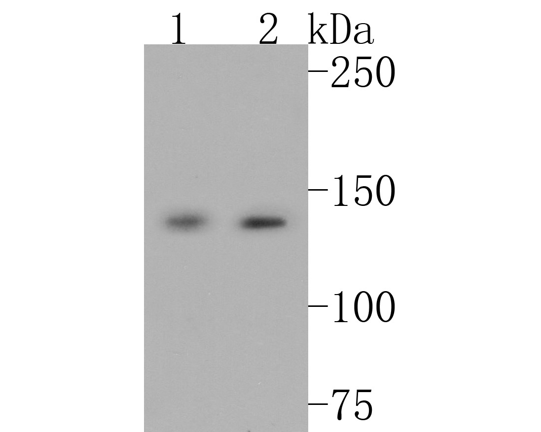 Western blot analysis of Leptin Receptor on different lysates. Proteins were transferred to a PVDF membrane and blocked with 5% BSA in PBS for 1 hour at room temperature. The primary antibody (ET1704-44, 1/500) was used in 5% BSA at room temperature for 2 hours. Goat Anti-Rabbit IgG - HRP Secondary Antibody (HA1001) at 1:200,000 dilution was used for 1 hour at room temperature.<br />
Positive control: <br />
Lane 1: Mouse lung tissue lysate<br />
Lane 2: Mouse liver tissue lysate