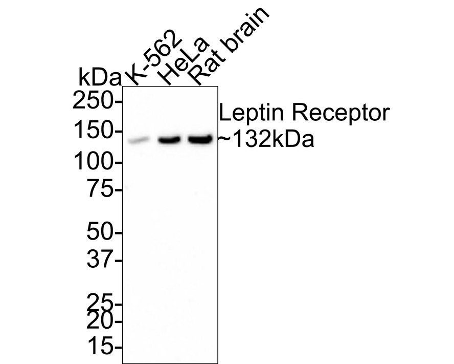 Western blot analysis of Leptin Receptor on different lysates with Rabbit anti-Leptin Receptor antibody (ET1704-44) at 1/1,000 dilution.<br />
<br />
Lane 1: K-562 cell lysate (16 µg/Lane)<br />
Lane 2: HeLa cell lysate (20 µg/Lane)<br />
Lane 3: Rat brain tissue lysate (32 µg/Lane)<br />
<br />
Predicted band size: 132 kDa<br />
Observed band size: 132 kDa<br />
<br />
Exposure time: 3 minutes;<br />
<br />
4-20% SDS-PAGE gel.<br />
<br />
Proteins were transferred to a PVDF membrane and blocked with 5% NFDM/TBST for 1 hour at room temperature. The primary antibody (ET1704-44) at 1/1,000 dilution was used in 5% NFDM/TBST at room temperature for 2 hours. Goat Anti-Rabbit IgG - HRP Secondary Antibody (HA1001) at 1:200,000 dilution was used for 1 hour at room temperature.
