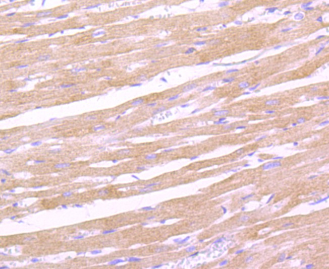 Immunohistochemical analysis of paraffin-embedded rat heart tissue using anti-Leptin Receptor antibody. The section was pre-treated using heat mediated antigen retrieval with Tris-EDTA buffer (pH 8.0-8.4) for 20 minutes.The tissues were blocked in 5% BSA for 30 minutes at room temperature, washed with ddH2O and PBS, and then probed with the primary antibody (ET1704-44, 1/50) for 30 minutes at room temperature. The detection was performed using an HRP conjugated compact polymer system. DAB was used as the chromogen. Tissues were counterstained with hematoxylin and mounted with DPX.