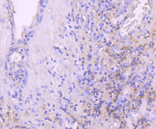 Immunohistochemical analysis of paraffin-embedded human prostate tissue using anti-Leptin Receptor antibody. The section was pre-treated using heat mediated antigen retrieval with Tris-EDTA buffer (pH 8.0-8.4) for 20 minutes.The tissues were blocked in 5% BSA for 30 minutes at room temperature, washed with ddH2O and PBS, and then probed with the primary antibody (ET1704-44, 1/50) for 30 minutes at room temperature. The detection was performed using an HRP conjugated compact polymer system. DAB was used as the chromogen. Tissues were counterstained with hematoxylin and mounted with DPX.