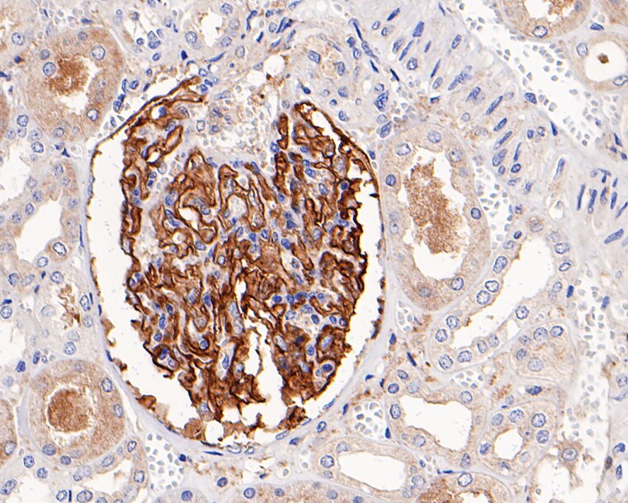 Immunohistochemical analysis of paraffin-embedded human kidney tissue with Rabbit anti-Leptin Receptor antibody (ET1704-44) at 1/1,000 dilution.<br />
<br />
The section was pre-treated using heat mediated antigen retrieval with Tris-EDTA buffer (pH 9.0) for 20 minutes. The tissues were blocked in 1% BSA for 20 minutes at room temperature, washed with ddH2O and PBS, and then probed with the primary antibody (ET1704-44) at 1/1,000 dilution for 1 hour at room temperature. The detection was performed using an HRP conjugated compact polymer system. DAB was used as the chromogen. Tissues were counterstained with hematoxylin and mounted with DPX.