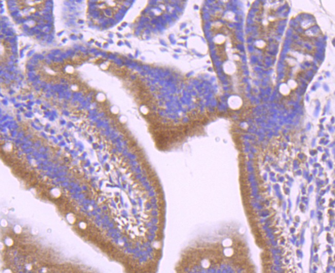 Immunohistochemical analysis of paraffin-embedded mouse small intestine tissue using anti-Leptin Receptor antibody. The section was pre-treated using heat mediated antigen retrieval with Tris-EDTA buffer (pH 8.0-8.4) for 20 minutes.The tissues were blocked in 5% BSA for 30 minutes at room temperature, washed with ddH2O and PBS, and then probed with the primary antibody (ET1704-44, 1/50) for 30 minutes at room temperature. The detection was performed using an HRP conjugated compact polymer system. DAB was used as the chromogen. Tissues were counterstained with hematoxylin and mounted with DPX.