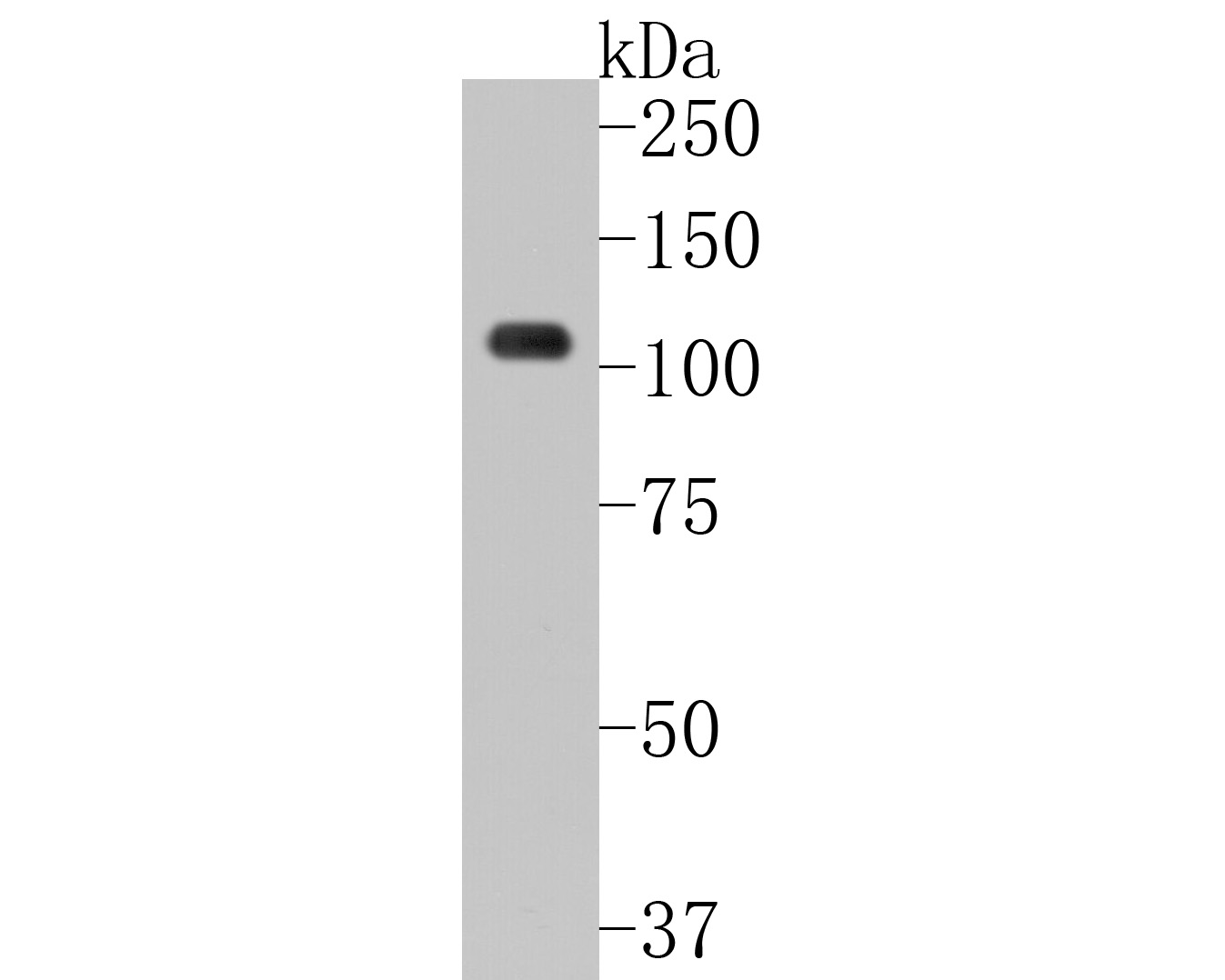 Western blot analysis of NFAT2 on K562 cell lysates. Proteins were transferred to a PVDF membrane and blocked with 5% BSA in PBS for 1 hour at room temperature. The primary antibody (ET1704-45, 1/500) was used in 5% BSA at room temperature for 2 hours. Goat Anti-Rabbit IgG - HRP Secondary Antibody (HA1001) at 1:5,000 dilution was used for 1 hour at room temperature.