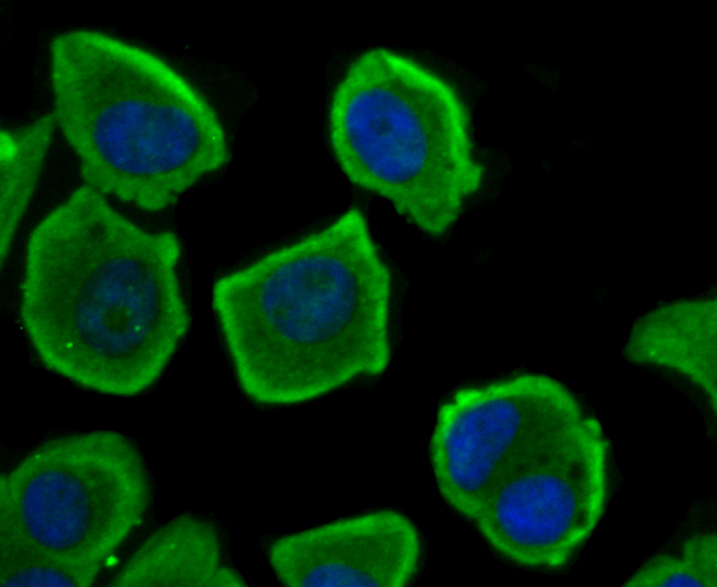 ICC staining of NFAT2 in MCF-7 cells (green). Formalin fixed cells were permeabilized with 0.1% Triton X-100 in TBS for 10 minutes at room temperature and blocked with 1% Blocker BSA for 15 minutes at room temperature. Cells were probed with the primary antibody (ET1704-45, 1/50) for 1 hour at room temperature, washed with PBS. Alexa Fluor®488 Goat anti-Rabbit IgG was used as the secondary antibody at 1/1,000 dilution. The nuclear counter stain is DAPI (blue).