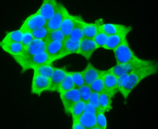 ICC staining of NFAT2 in 293T cells (green). Formalin fixed cells were permeabilized with 0.1% Triton X-100 in TBS for 10 minutes at room temperature and blocked with 1% Blocker BSA for 15 minutes at room temperature. Cells were probed with the primary antibody (ET1704-45, 1/50) for 1 hour at room temperature, washed with PBS. Alexa Fluor®488 Goat anti-Rabbit IgG was used as the secondary antibody at 1/1,000 dilution. The nuclear counter stain is DAPI (blue).