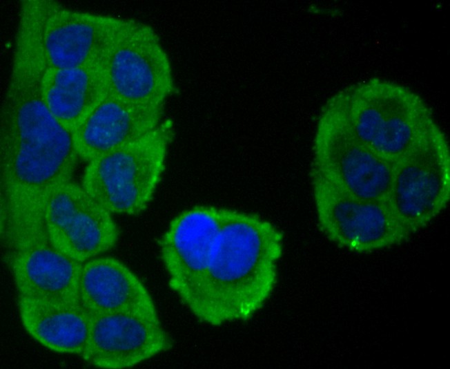 ICC staining of NFAT2 in Hela cells (green). Formalin fixed cells were permeabilized with 0.1% Triton X-100 in TBS for 10 minutes at room temperature and blocked with 1% Blocker BSA for 15 minutes at room temperature. Cells were probed with the primary antibody (ET1704-45, 1/50) for 1 hour at room temperature, washed with PBS. Alexa Fluor®488 Goat anti-Rabbit IgG was used as the secondary antibody at 1/1,000 dilution. The nuclear counter stain is DAPI (blue).