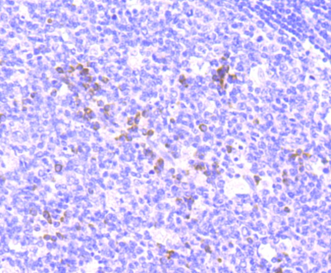Immunohistochemical analysis of paraffin-embedded human tonsil tissue using anti-NFAT2 antibody. The section was pre-treated using heat mediated antigen retrieval with Tris-EDTA buffer (pH 8.0-8.4) for 20 minutes.The tissues were blocked in 5% BSA for 30 minutes at room temperature, washed with ddH2O and PBS, and then probed with the primary antibody (ET1704-45, 1/50) for 30 minutes at room temperature. The detection was performed using an HRP conjugated compact polymer system. DAB was used as the chromogen. Tissues were counterstained with hematoxylin and mounted with DPX.