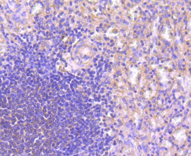 Immunohistochemical analysis of paraffin-embedded human spleen tissue using anti-NFAT2 antibody. The section was pre-treated using heat mediated antigen retrieval with Tris-EDTA buffer (pH 8.0-8.4) for 20 minutes.The tissues were blocked in 5% BSA for 30 minutes at room temperature, washed with ddH2O and PBS, and then probed with the primary antibody (ET1704-45, 1/50) for 30 minutes at room temperature. The detection was performed using an HRP conjugated compact polymer system. DAB was used as the chromogen. Tissues were counterstained with hematoxylin and mounted with DPX.