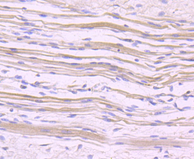 Immunohistochemical analysis of paraffin-embedded human skeletal muscle tissue using anti-NFAT2 antibody. The section was pre-treated using heat mediated antigen retrieval with Tris-EDTA buffer (pH 8.0-8.4) for 20 minutes.The tissues were blocked in 5% BSA for 30 minutes at room temperature, washed with ddH2O and PBS, and then probed with the primary antibody (ET1704-45, 1/50) for 30 minutes at room temperature. The detection was performed using an HRP conjugated compact polymer system. DAB was used as the chromogen. Tissues were counterstained with hematoxylin and mounted with DPX.