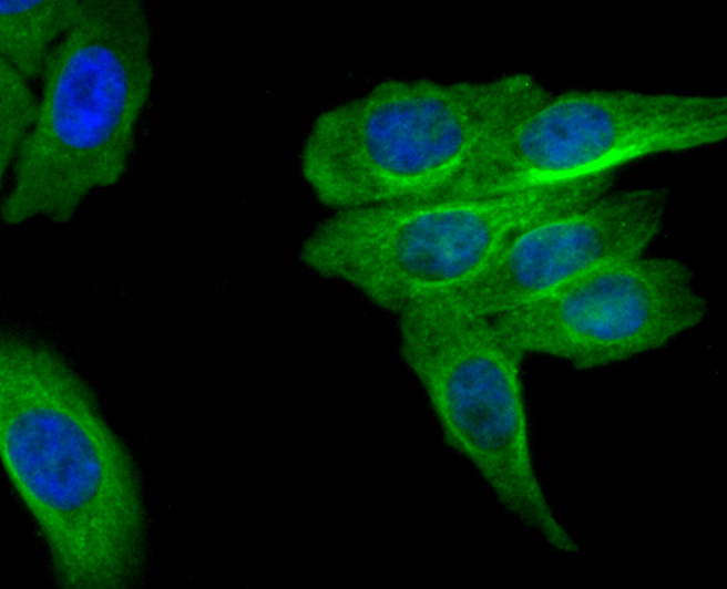 ICC staining of MRP2 in 293T cells (green). Formalin fixed cells were permeabilized with 0.1% Triton X-100 in TBS for 10 minutes at room temperature and blocked with 1% Blocker BSA for 15 minutes at room temperature. Cells were probed with the primary antibody (ET1704-47, 1/50) for 1 hour at room temperature, washed with PBS. Alexa Fluor®488 Goat anti-Rabbit IgG was used as the secondary antibody at 1/1,000 dilution. The nuclear counter stain is DAPI (blue).