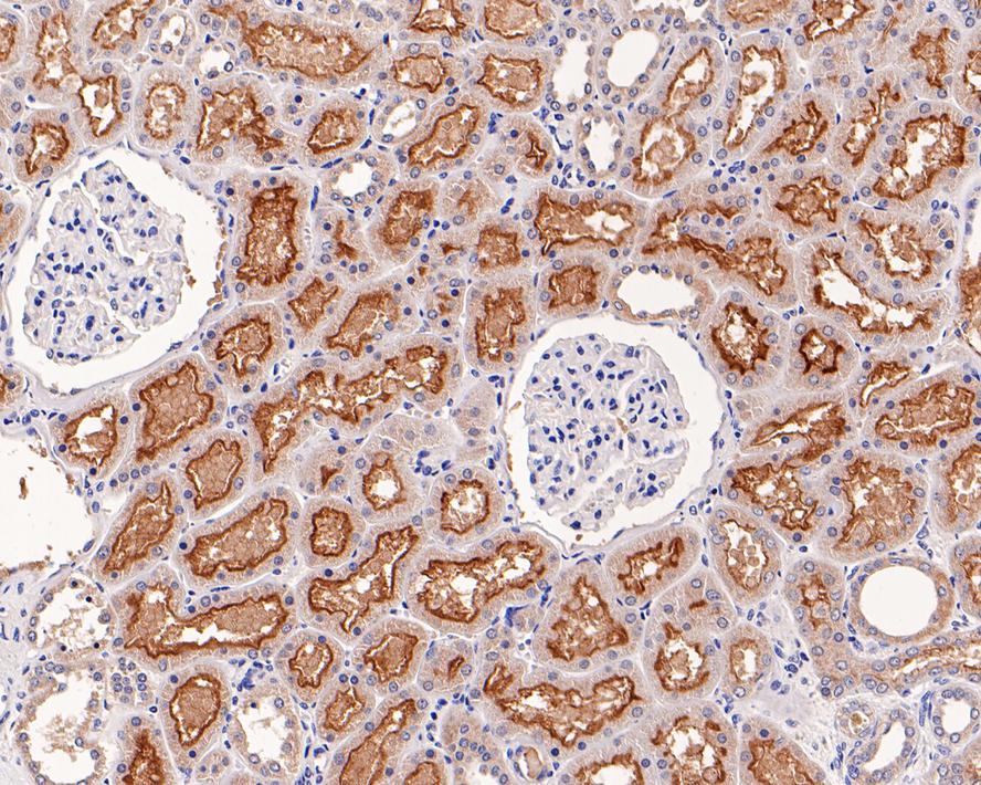 Immunohistochemical analysis of paraffin-embedded human pancreas tissue using anti-MRP2 antibody. The section was pre-treated using heat mediated antigen retrieval with Tris-EDTA buffer (pH 8.0-8.4) for 20 minutes.The tissues were blocked in 5% BSA for 30 minutes at room temperature, washed with ddH2O and PBS, and then probed with the primary antibody (ET1704-47, 1/50) for 30 minutes at room temperature. The detection was performed using an HRP conjugated compact polymer system. DAB was used as the chromogen. Tissues were counterstained with hematoxylin and mounted with DPX.