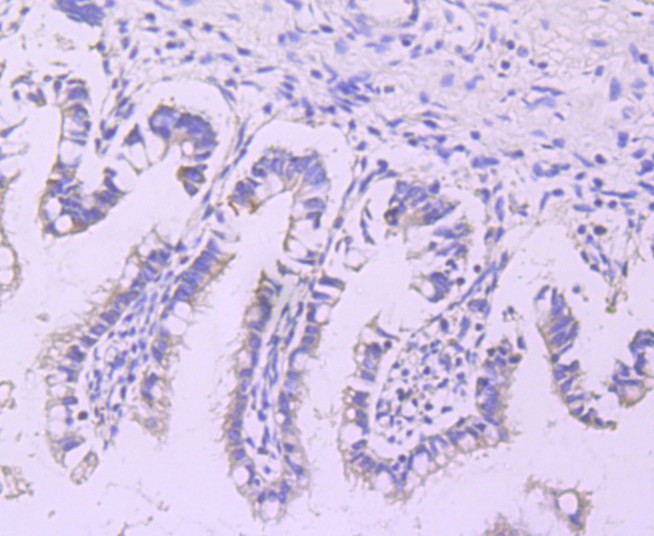 Immunohistochemical analysis of paraffin-embedded human ileum tissue using anti-Lipoprotein lipase antibody. The section was pre-treated using heat mediated antigen retrieval with Tris-EDTA buffer (pH 9.0) for 20 minutes.The tissues were blocked in 1% BSA for 30 minutes at room temperature, washed with ddH2O and PBS, and then probed with the primary antibody (ET1704-48, 1/50) for 30 minutes at room temperature. The detection was performed using an HRP conjugated compact polymer system. DAB was used as the chromogen. Tissues were counterstained with hematoxylin and mounted with DPX.