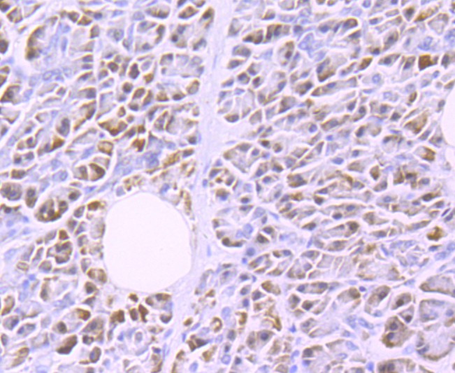 Immunohistochemical analysis of paraffin-embedded human pancreas tissue using anti-Lipoprotein lipase antibody. The section was pre-treated using heat mediated antigen retrieval with Tris-EDTA buffer (pH 9.0) for 20 minutes.The tissues were blocked in 1% BSA for 30 minutes at room temperature, washed with ddH2O and PBS, and then probed with the primary antibody (ET1704-48, 1/50) for 30 minutes at room temperature. The detection was performed using an HRP conjugated compact polymer system. DAB was used as the chromogen. Tissues were counterstained with hematoxylin and mounted with DPX.