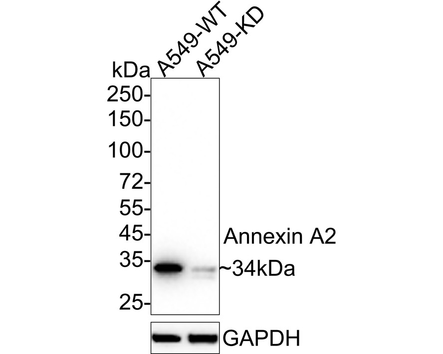 Western blot analysis of Annexin A2 on different lysates. Proteins were transferred to a PVDF membrane and blocked with 5% BSA in PBS for 1 hour at room temperature. The primary antibody (ET1704-49, 1/500) was used in 5% BSA at room temperature for 2 hours. Goat Anti-Rabbit IgG - HRP Secondary Antibody (HA1001) at 1:5,000 dilution was used for 1 hour at room temperature.<br />
Positive control: <br />
Lane 1: Hela cell lysate<br />
Lane 2: human kidney tissue lysate<br />
Lane 3: mouse testis tissue lysate