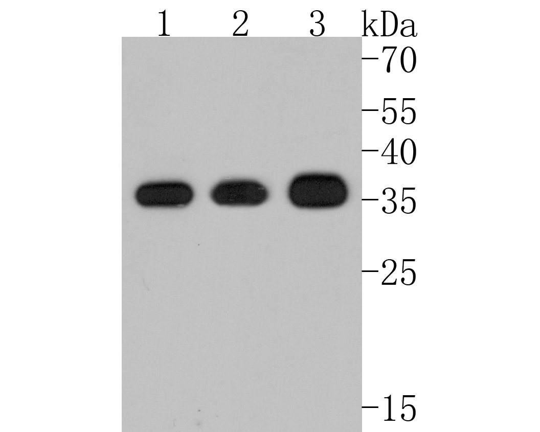 ICC staining of Annexin A2 in Hela cells (green). Formalin fixed cells were permeabilized with 0.1% Triton X-100 in TBS for 10 minutes at room temperature and blocked with 1% Blocker BSA for 15 minutes at room temperature. Cells were probed with the primary antibody (ET1704-49, 1/50) for 1 hour at room temperature, washed with PBS. Alexa Fluor®488 Goat anti-Rabbit IgG was used as the secondary antibody at 1/1,000 dilution. The nuclear counter stain is DAPI (blue).