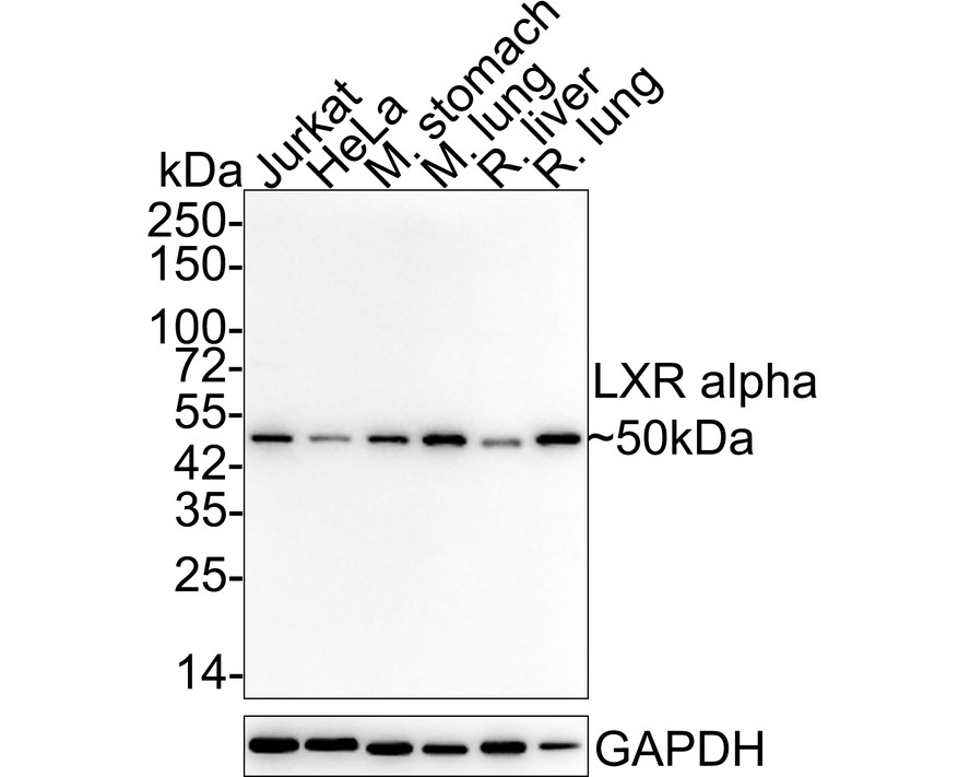 Western blot analysis of LXR alpha on human liver tissue lysates. Proteins were transferred to a PVDF membrane and blocked with 5% BSA in PBS for 1 hour at room temperature. The primary antibody (ET1704-51, 1/500) was used in 5% BSA at room temperature for 2 hours. Goat Anti-Rabbit IgG - HRP Secondary Antibody (HA1001) at 1:5,000 dilution was used for 1 hour at room temperature.