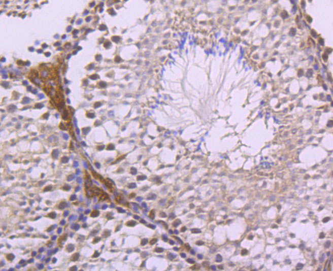 Immunohistochemical analysis of paraffin-embedded human placenta tissue using anti-LXR alpha antibody. The section was pre-treated using heat mediated antigen retrieval with Tris-EDTA buffer (pH 8.0-8.4) for 20 minutes.The tissues were blocked in 5% BSA for 30 minutes at room temperature, washed with ddH2O and PBS, and then probed with the primary antibody (ET1704-51, 1/50) for 30 minutes at room temperature. The detection was performed using an HRP conjugated compact polymer system. DAB was used as the chromogen. Tissues were counterstained with hematoxylin and mounted with DPX.