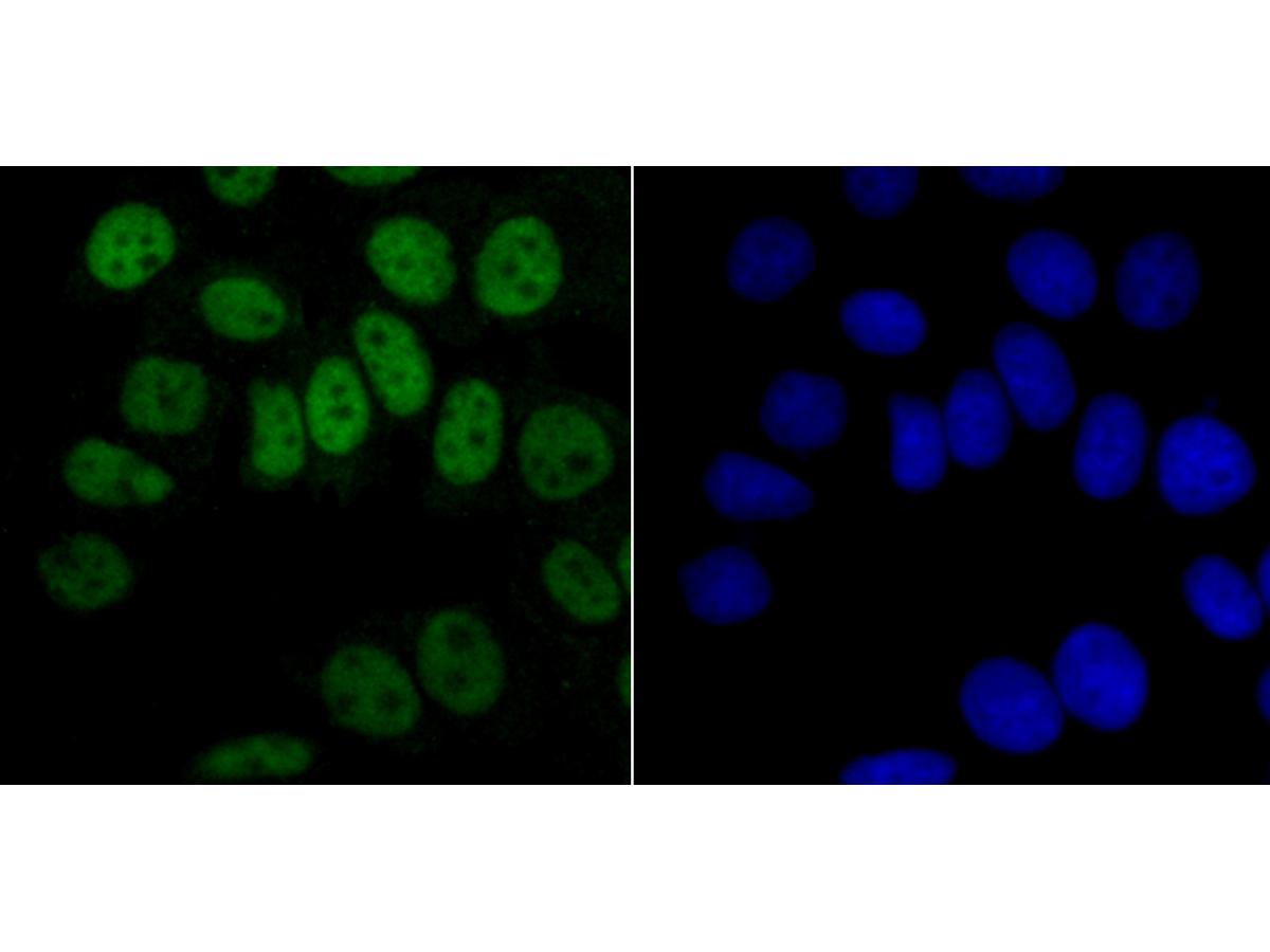 ICC staining of hnRNP A1 in MCF-7 cells (green). Formalin fixed cells were permeabilized with 0.1% Triton X-100 in TBS for 10 minutes at room temperature and blocked with 1% Blocker BSA for 15 minutes at room temperature. Cells were probed with the primary antibody (ET1704-52, 1/50) for 1 hour at room temperature, washed with PBS. Alexa Fluor®488 Goat anti-Rabbit IgG was used as the secondary antibody at 1/1,000 dilution. The nuclear counter stain is DAPI (blue).
