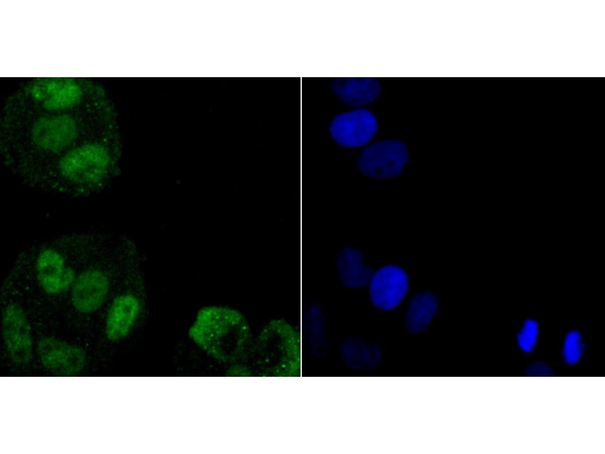 ICC staining of hnRNP A1 in Hela cells (green). Formalin fixed cells were permeabilized with 0.1% Triton X-100 in TBS for 10 minutes at room temperature and blocked with 1% Blocker BSA for 15 minutes at room temperature. Cells were probed with the primary antibody (ET1704-52, 1/50) for 1 hour at room temperature, washed with PBS. Alexa Fluor®488 Goat anti-Rabbit IgG was used as the secondary antibody at 1/1,000 dilution. The nuclear counter stain is DAPI (blue).