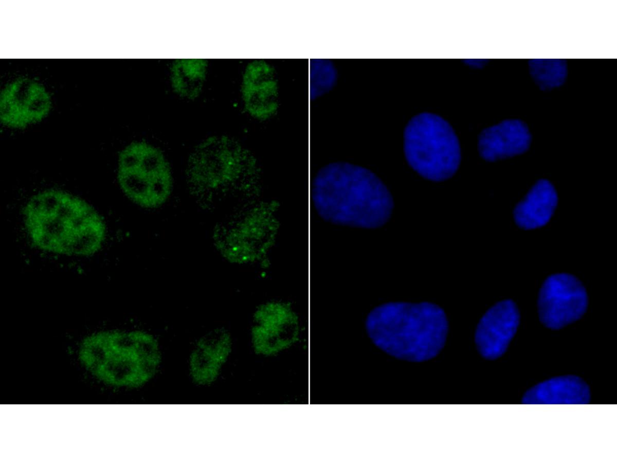 ICC staining of hnRNP A1 in HepG2 cells (green). Formalin fixed cells were permeabilized with 0.1% Triton X-100 in TBS for 10 minutes at room temperature and blocked with 1% Blocker BSA for 15 minutes at room temperature. Cells were probed with the primary antibody (ET1704-52, 1/50) for 1 hour at room temperature, washed with PBS. Alexa Fluor®488 Goat anti-Rabbit IgG was used as the secondary antibody at 1/1,000 dilution. The nuclear counter stain is DAPI (blue).