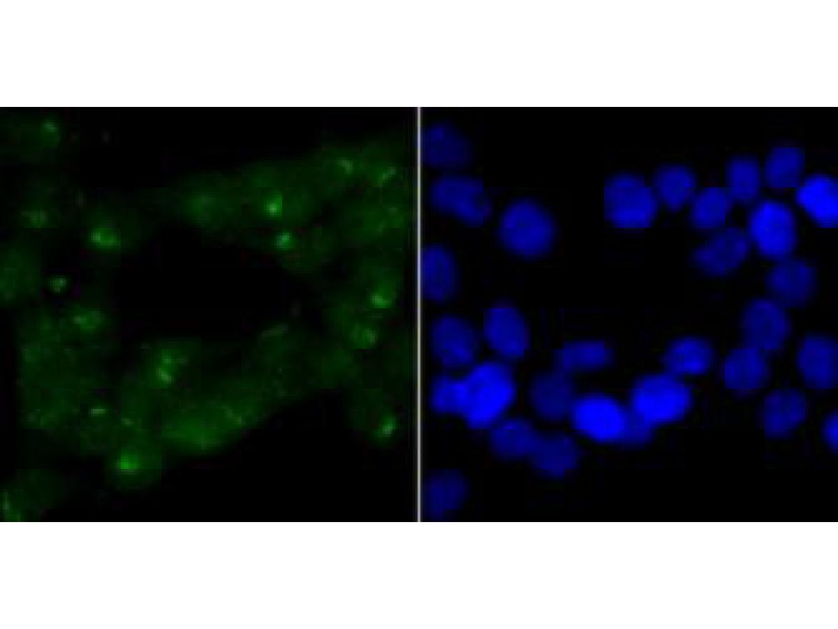 ICC staining of CHD4 in 293T cells (green). Formalin fixed cells were permeabilized with 0.1% Triton X-100 in TBS for 10 minutes at room temperature and blocked with 1% Blocker BSA for 15 minutes at room temperature. Cells were probed with the primary antibody (ET1704-53, 1/200) for 1 hour at room temperature, washed with PBS. Alexa Fluor®488 Goat anti-Rabbit IgG was used as the secondary antibody at 1/100 dilution. The nuclear counter stain is DAPI (blue).