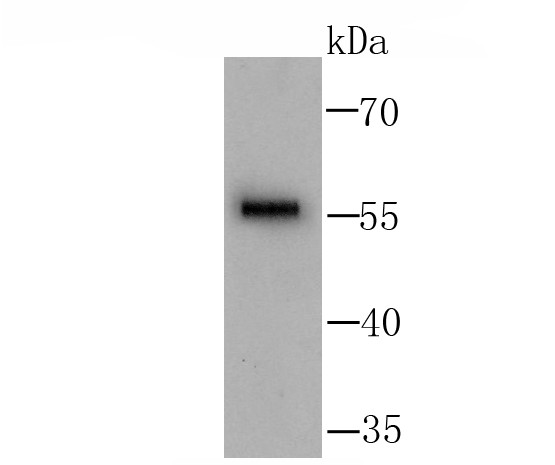 Western blot analysis of EAAT1 on mouse brain tissue lysates. Proteins were transferred to a PVDF membrane and blocked with 5% BSA in PBS for 1 hour at room temperature. The primary antibody (ET1704-54, 1/500) was used in 5% BSA at room temperature for 2 hours. Goat Anti-Rabbit IgG - HRP Secondary Antibody (HA1001) at 1:5,000 dilution was used for 1 hour at room temperature.