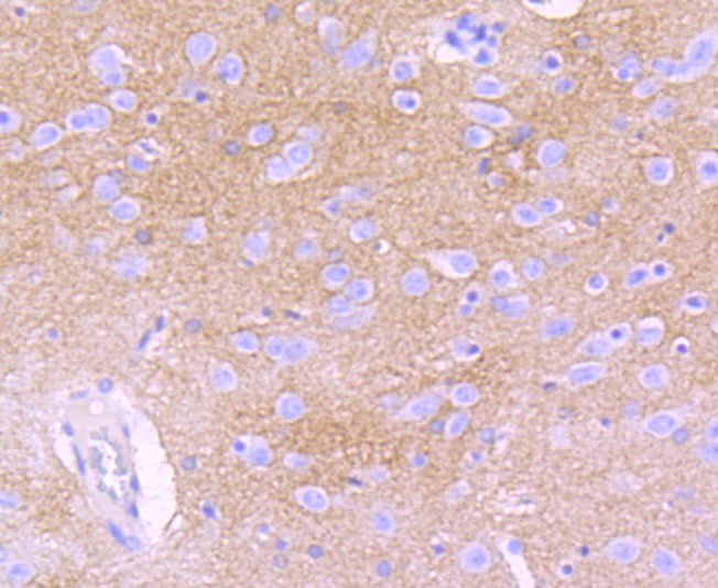 Immunohistochemical analysis of paraffin-embedded rat brain tissue using anti-EAAT1 antibody. The section was pre-treated using heat mediated antigen retrieval with Tris-EDTA buffer (pH 8.0-8.4) for 20 minutes.The tissues were blocked in 5% BSA for 30 minutes at room temperature, washed with ddH2O and PBS, and then probed with the primary antibody (ET1704-54, 1/50) for 1 hour at room temperature. The detection was performed using an HRP conjugated compact polymer system. DAB was used as the chromogen. Tissues were counterstained with hematoxylin and mounted with DPX.