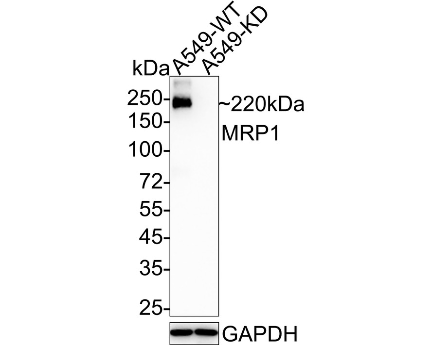 Immunohistochemical analysis of paraffin-embedded human tonsil tissue using anti-MRP1 antibody. The section was pre-treated using heat mediated antigen retrieval with Tris-EDTA buffer (pH 8.0-8.4) for 20 minutes.The tissues were blocked in 5% BSA for 30 minutes at room temperature, washed with ddH2O and PBS, and then probed with the primary antibody (ET1704-56, 1/50) for 30 minutes at room temperature. The detection was performed using an HRP conjugated compact polymer system. DAB was used as the chromogen. Tissues were counterstained with hematoxylin and mounted with DPX.