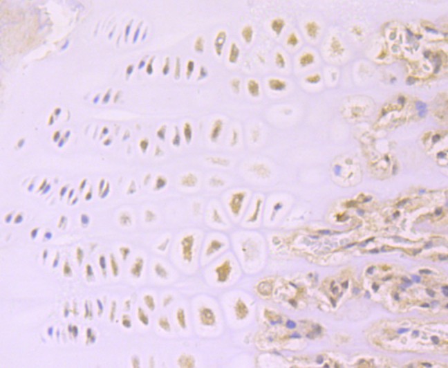 Immunohistochemical analysis of paraffin-embedded rat cartilage tissue using anti-Aggrecan antibody. The section was pre-treated using heat mediated antigen retrieval with Tris-EDTA buffer (pH 8.0-8.4) for 20 minutes.The tissues were blocked in 5% BSA for 30 minutes at room temperature, washed with ddH2O and PBS, and then probed with the primary antibody (ET1704-57, 1/50) for 30 minutes at room temperature. The detection was performed using an HRP conjugated compact polymer system. DAB was used as the chromogen. Tissues were counterstained with hematoxylin and mounted with DPX.