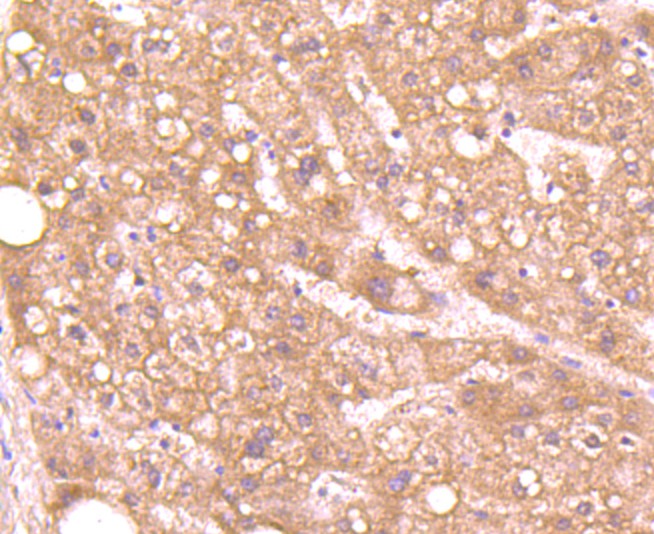 Immunohistochemical analysis of paraffin-embedded human liver tissue using anti-Aggrecan antibody. The section was pre-treated using heat mediated antigen retrieval with Tris-EDTA buffer (pH 8.0-8.4) for 20 minutes.The tissues were blocked in 5% BSA for 30 minutes at room temperature, washed with ddH2O and PBS, and then probed with the primary antibody (ET1704-57, 1/50) for 30 minutes at room temperature. The detection was performed using an HRP conjugated compact polymer system. DAB was used as the chromogen. Tissues were counterstained with hematoxylin and mounted with DPX.