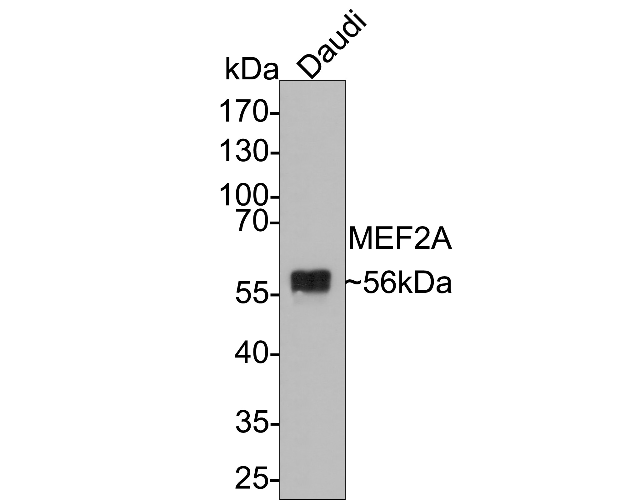 Western blot analysis of MEF2A on Daudi cell lysates with Rabbit anti-MEF2A antibody (ET1704-58) at 1/500 dilution.<br />
<br />
Lysates/proteins at 10 µg/Lane.<br />
<br />
Predicted band size: 54 kDa<br />
Observed band size: 55 kDa<br />
<br />
Exposure time: 2 minutes;<br />
<br />
10% SDS-PAGE gel.<br />
<br />
Proteins were transferred to a PVDF membrane and blocked with 5% NFDM/TBST for 1 hour at room temperature. The primary antibody (ET1704-58) at 1/500 dilution was used in 5% NFDM/TBST at room temperature for 2 hours. Goat Anti-Rabbit IgG - HRP Secondary Antibody (HA1001) at 1:300,000 dilution was used for 1 hour at room temperature.