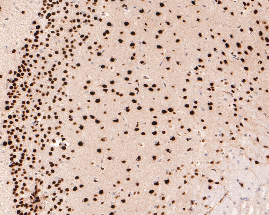 Immunohistochemical analysis of paraffin-embedded mouse brain tissue with Rabbit anti-MEF2A antibody (ET1704-58) at 1/500 dilution.<br />
<br />
The section was pre-treated using heat mediated antigen retrieval with sodium citrate buffer (pH 6.0) for 2 minutes. The tissues were blocked in 1% BSA for 20 minutes at room temperature, washed with ddH2O and PBS, and then probed with the primary antibody (ET1704-58) at 1/500 dilution for 1 hour at room temperature. The detection was performed using an HRP conjugated compact polymer system. DAB was used as the chromogen. Tissues were counterstained with hematoxylin and mounted with DPX.