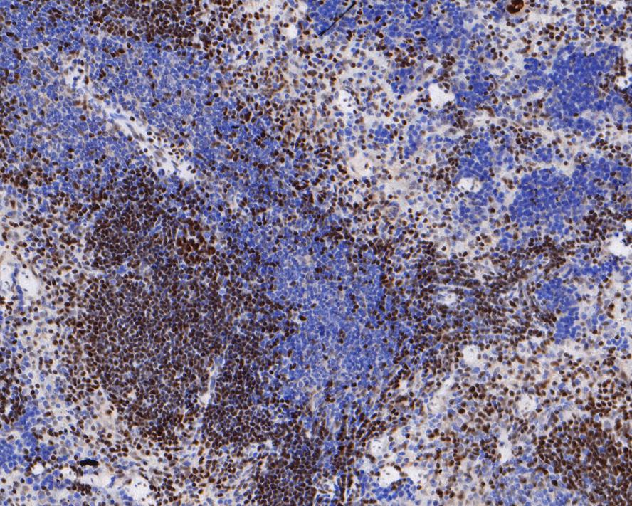 Immunohistochemical analysis of paraffin-embedded mouse spleen tissue with Rabbit anti-MEF2A antibody (ET1704-58) at 1/500 dilution.<br />
<br />
The section was pre-treated using heat mediated antigen retrieval with sodium citrate buffer (pH 6.0) for 2 minutes. The tissues were blocked in 1% BSA for 20 minutes at room temperature, washed with ddH2O and PBS, and then probed with the primary antibody (ET1704-58) at 1/500 dilution for 1 hour at room temperature. The detection was performed using an HRP conjugated compact polymer system. DAB was used as the chromogen. Tissues were counterstained with hematoxylin and mounted with DPX.